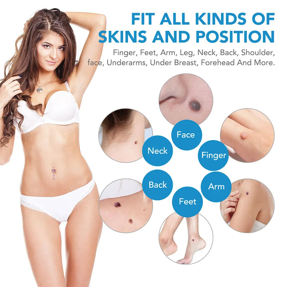2 en 1 Micro Micro Skin Tag Dispositif Dispositif standard et micro-étiquette de peau Kit d'élimination de la peau
