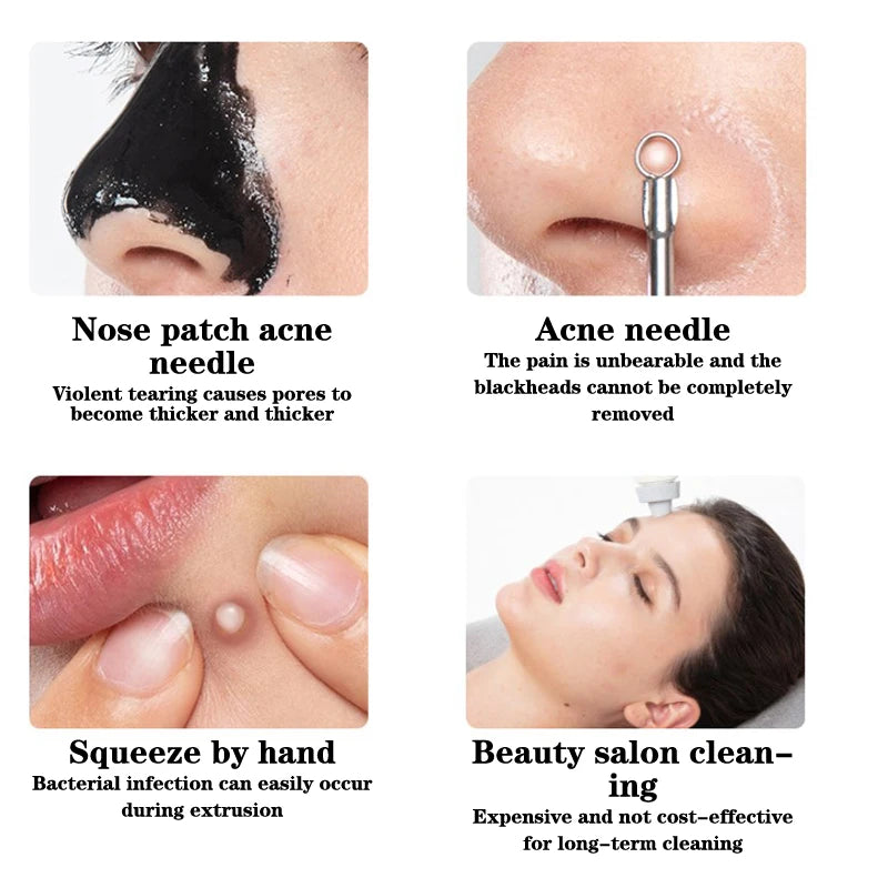 Spatule Spatule Exfoliator de la peau du visage
