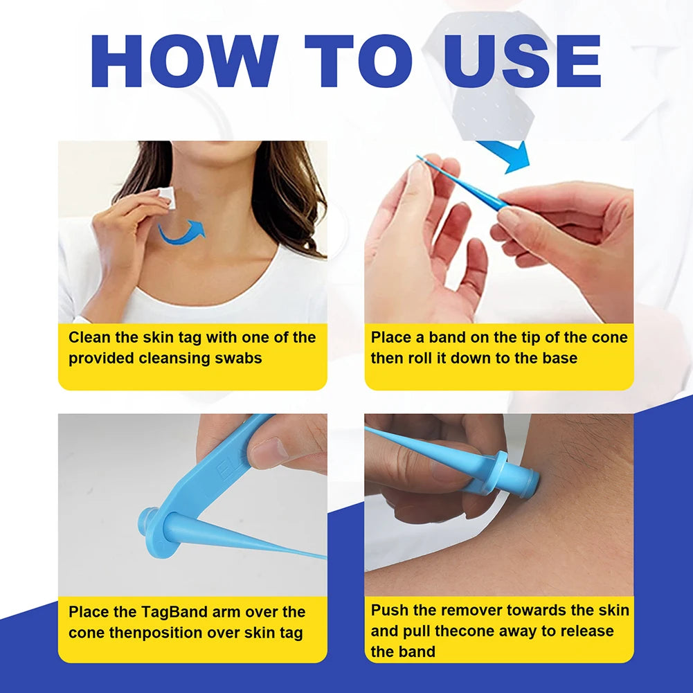 Double face enlever les verrues outils de soins de la peau du corps