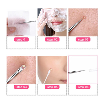 1 pcs Thead Black Comedone Acné Pimple Blemish Extracteur Remover en acier inoxydable Aigneles Outils Face Care Pores Clean